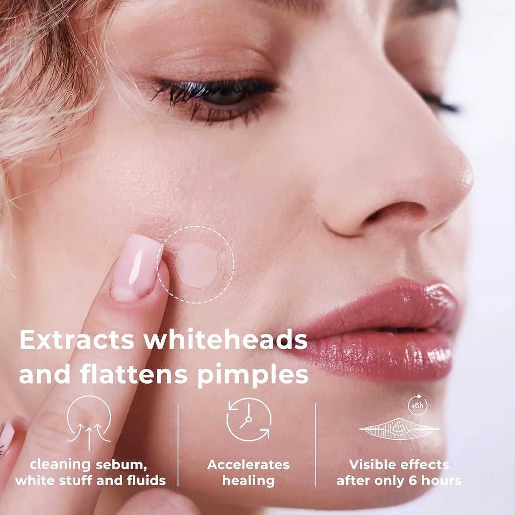 200/400/800-count packs of invisible acne patches. Covers pimples and blemishes. Gentle and non-irritating.